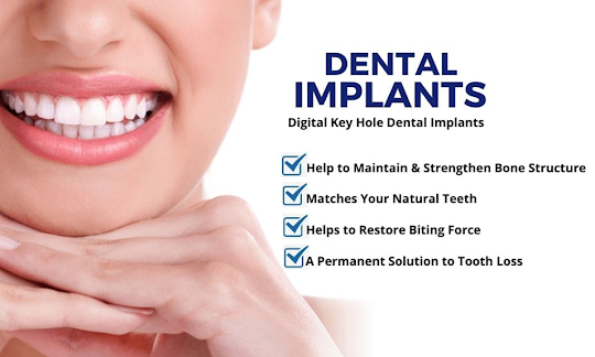 Dental Implant in Adelaide: Helps to Improve Your Smile