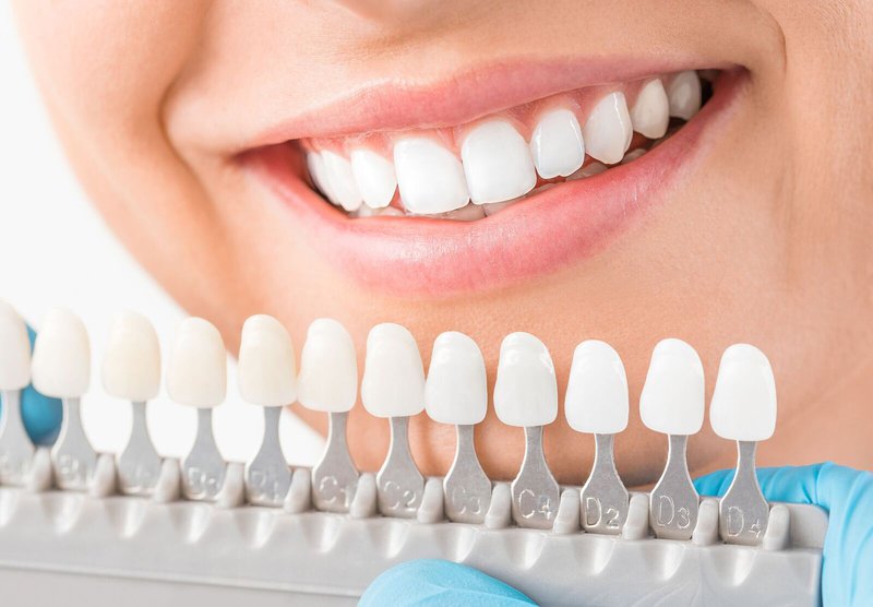 Teeth Whitening - (03 95788500) - BEDC