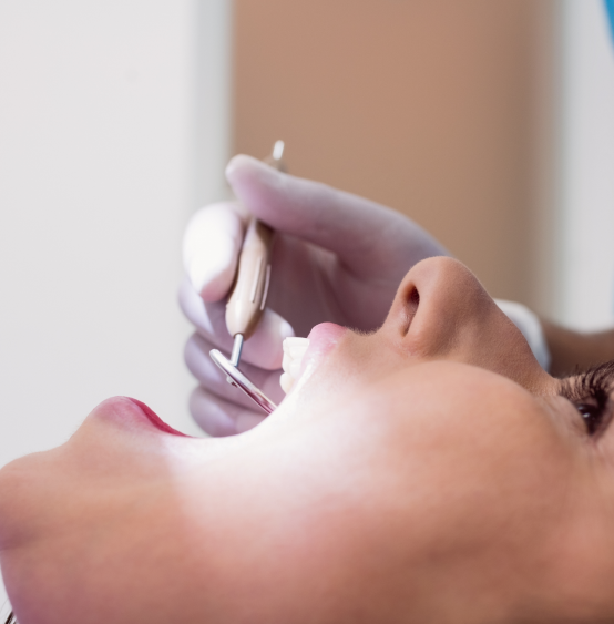 Trusted Family Dentist in Hallam|iDentistry