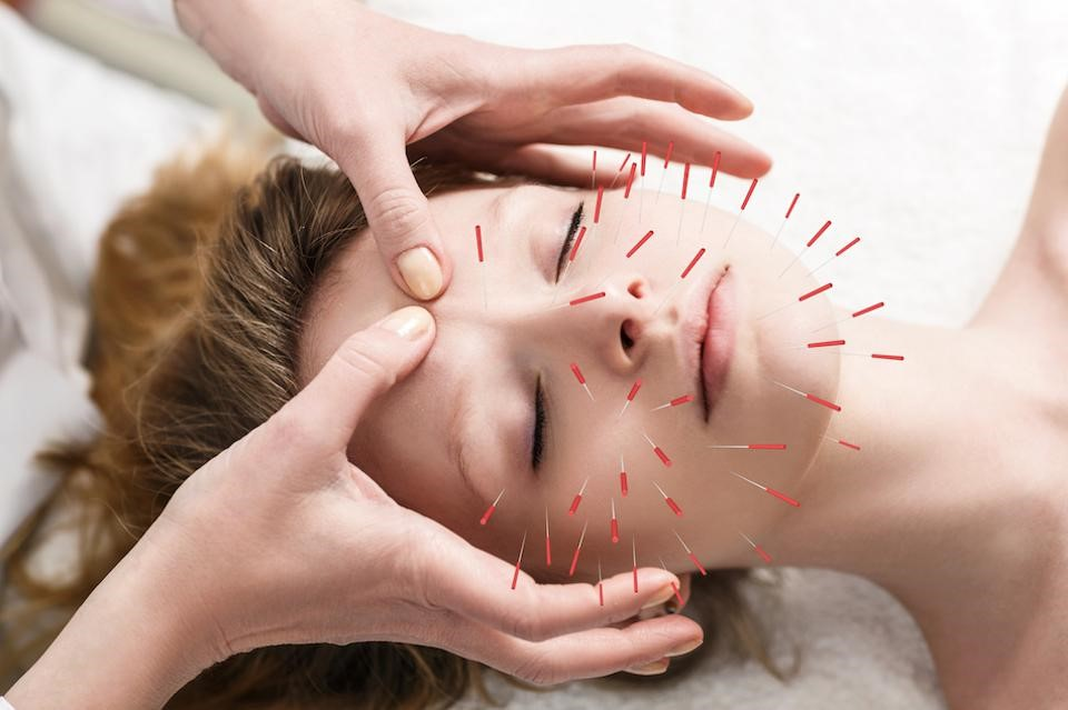 Is Cosmetic Acupuncture Worth the Investment? A Breakdown of Costs and Benefits