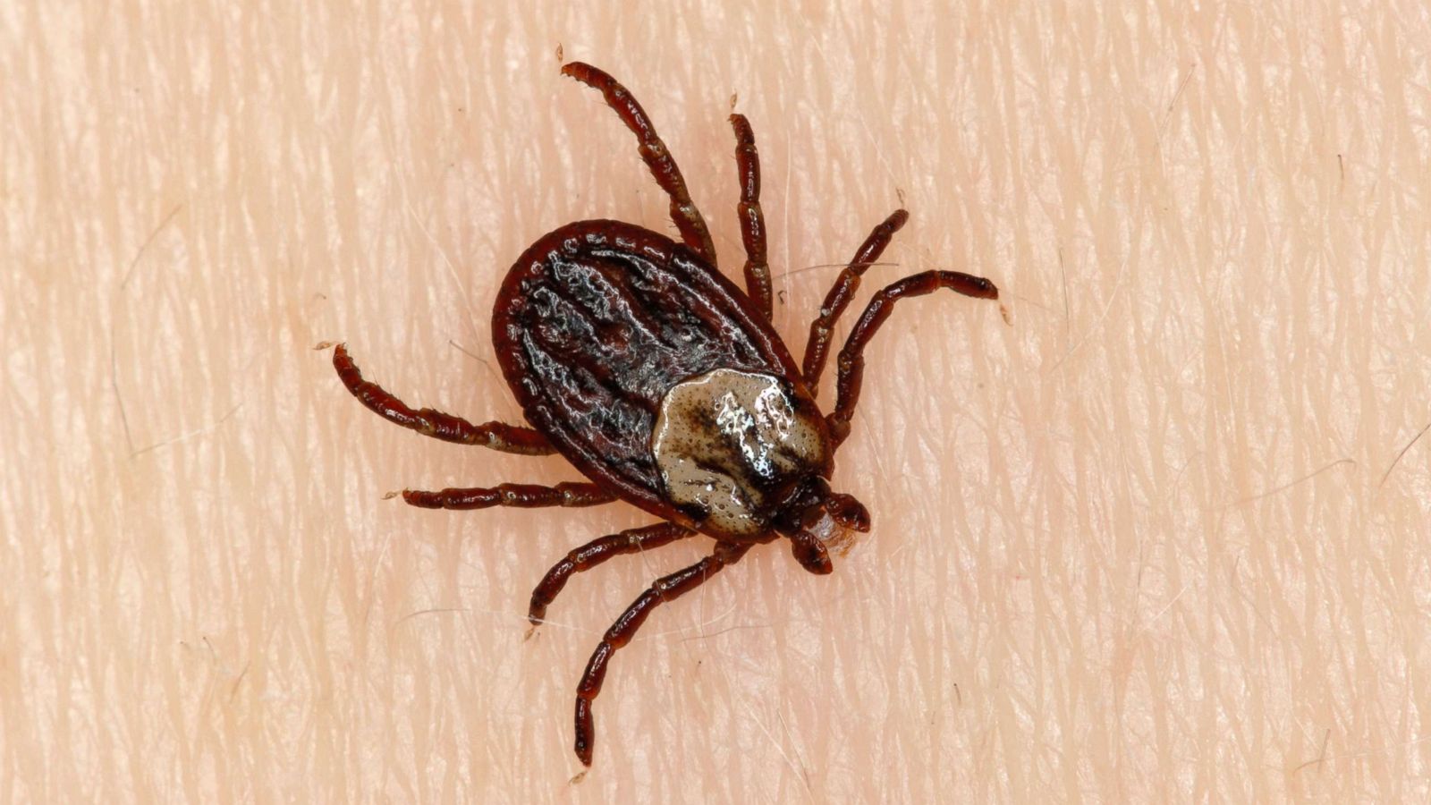How Tick Infestation Can Put You in Danger?