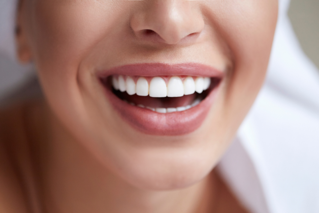 Different Types of Tooth Whitening: Which Option Is Right for You?